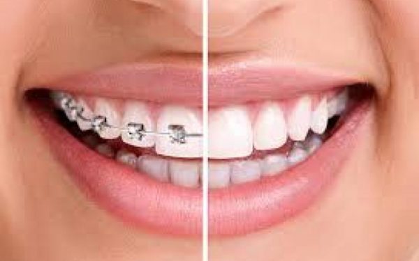 orthodontiki therapeia