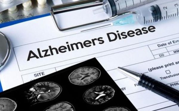 alzheimer